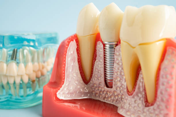 Best Tooth Extraction  in Horn Lake, MS